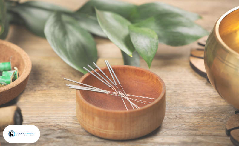 Acupuntura: Equilíbrio Natural para Corpo e Mente