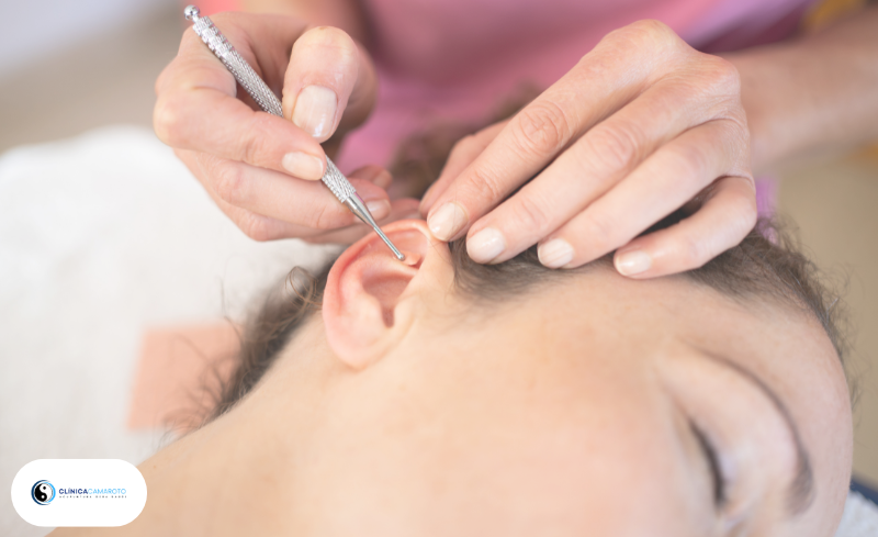 Auriculoterapia: Equilíbrio e Bem-Estar Através da Estimulação Auricular
