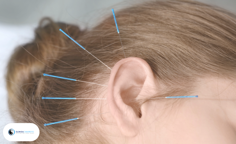 Acupuntura Auricular: Pequenos Pontos, Grandes Resultados