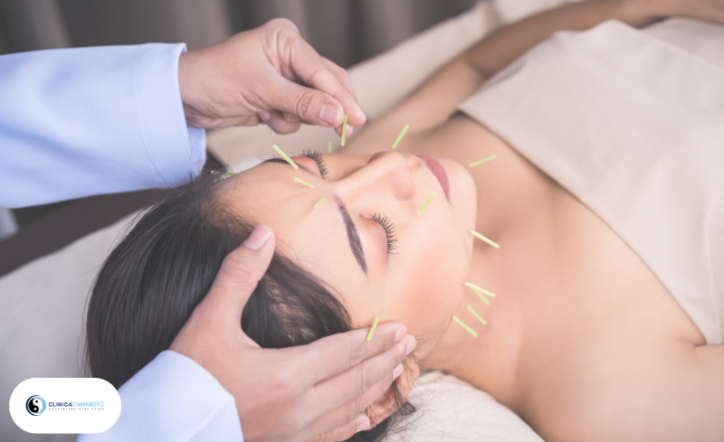 Acupuntura Estética: Beleza com Equilíbrio e Bem-Estar