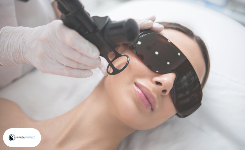 Laser Acupuntura: Tratamento Sem Agulhas e Alto Potencial Terapêutico