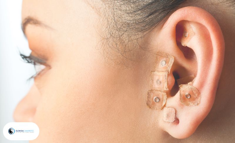 Auriculoterapia: Pequenos Pontos na Orelha, Grandes Resultados para a Saúde