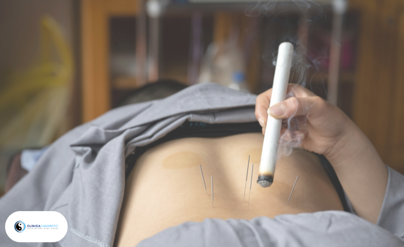 Moxabustão: O Poder do Calor no Equilíbrio Energético