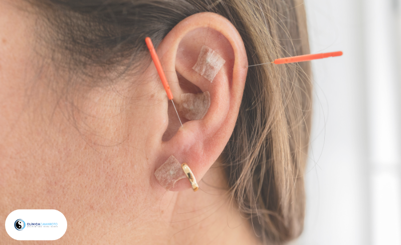 Auriculoterapia para Controle do Apetite e Compulsão Alimentar