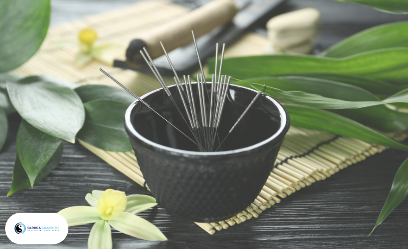 Acupuntura Preventiva: Por Que Cuidar da Saúde Antes da Dor Aparecer?